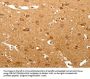 MAP1B Antibody
