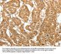 MAP1B Antibody