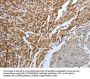 Rabbit anti-human PGR polyclonal antibody