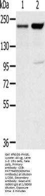 KDM5A Antibody