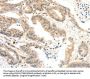RRAD Antibody