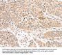 ATOX1 Antibody