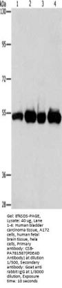 PDE4D Antibody