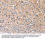 STK16 Antibody