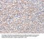 STK16 Antibody