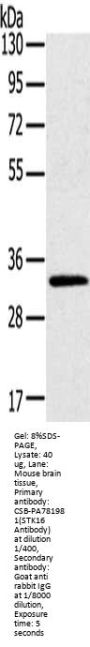 STK16 Antibody
