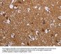 LIMK1 Antibody