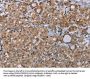 LIMK1 Antibody