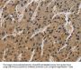 CORO1C Antibody