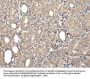 SERPINA7 Antibody