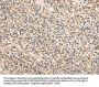SERPINA7 Antibody