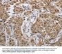 PRKAR1B Antibody