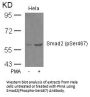 Phospho-SMAD2 (Ser467) Antibody