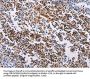 HDAC4 Antibody