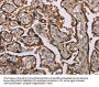 KIF2A Antibody