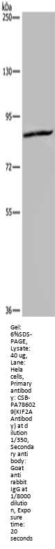 KIF2A Antibody