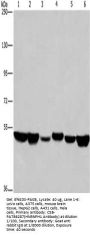HNRNPH1 Antibody