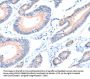 AADACL2 Antibody