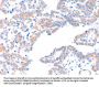 AADACL2 Antibody