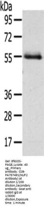 Rabbit anti-human NUF2 polyclonal antibody