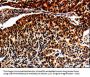 ALOX5 Antibody