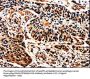 ALOX5 Antibody