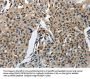 KDM1A Antibody
