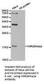 Histone H3R26me2a Antibody