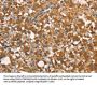 CALCRL Antibody