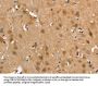 CALCRL Antibody