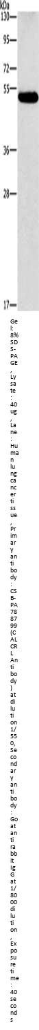 CALCRL Antibody