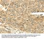 SERPINA12 Antibody