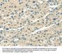 SERPINA12 Antibody