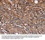 HP Antibody