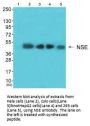 ENO2 Antibody