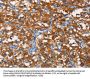 PFKP Antibody