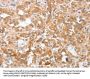 PLA2G4A Antibody