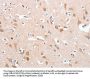 PLA2G4A Antibody