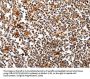 PIK3R1 Antibody
