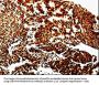 MMP13 Antibody