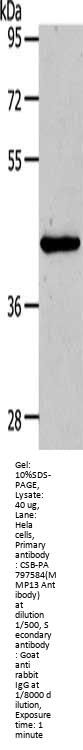 MMP13 Antibody