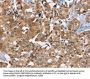 PHYH Antibody
