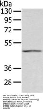 Rabbit anti-human AGPAT9 polyclonal antibody