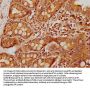 CLEC14A Antibody