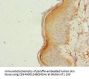 ZC3HC1 Antibody