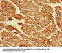 LDHD Antibody