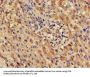 LDHD Antibody