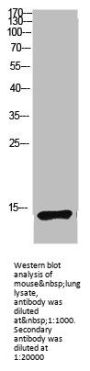 MAP1LC3B Antibody
