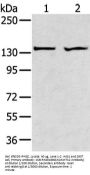 ADAMTS2 Antibody