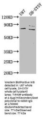 TIPARP Antibody